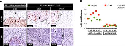 The molecular mechanisms underlying neutrophil infiltration in vessel co-opting colorectal cancer liver metastases